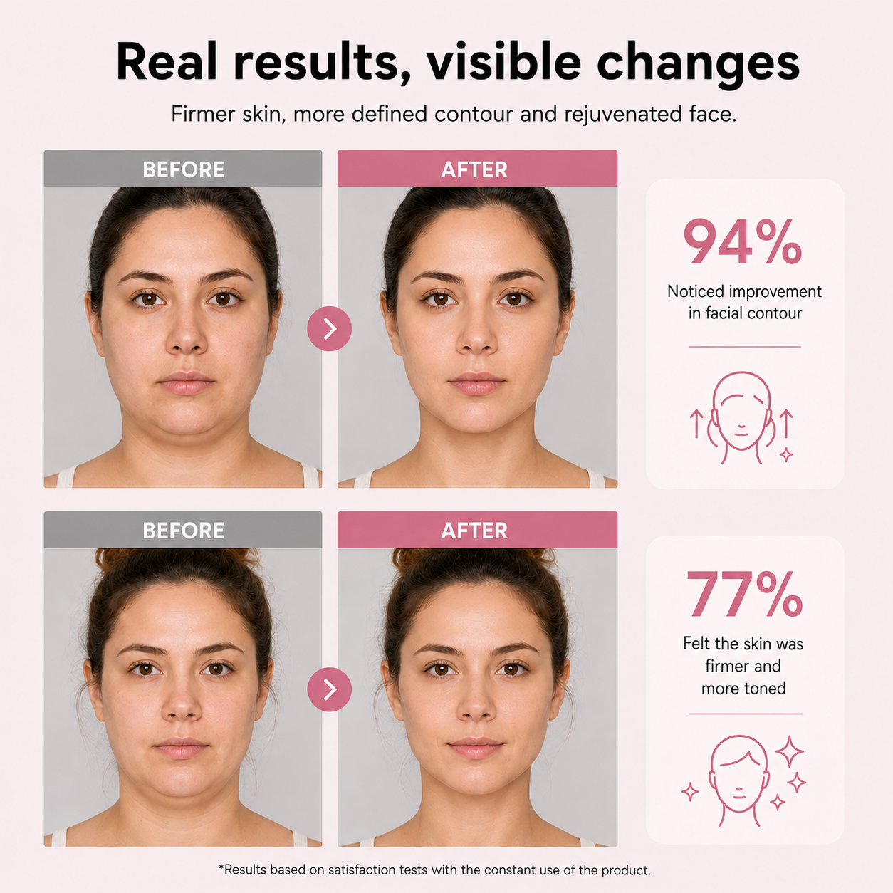 LIFTING FACIAL V-LINE PRO