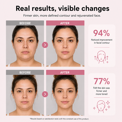 LIFTING FACIAL V-LINE PRO