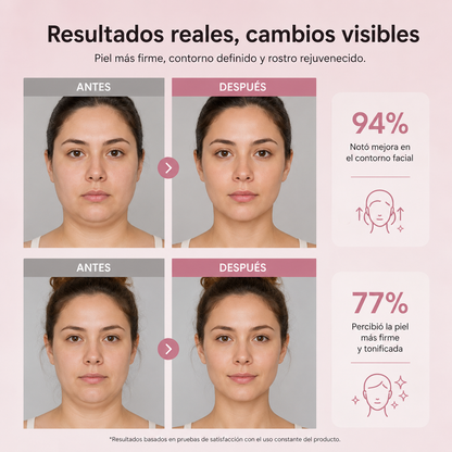 LIFTING FACIAL V-LINE PRO